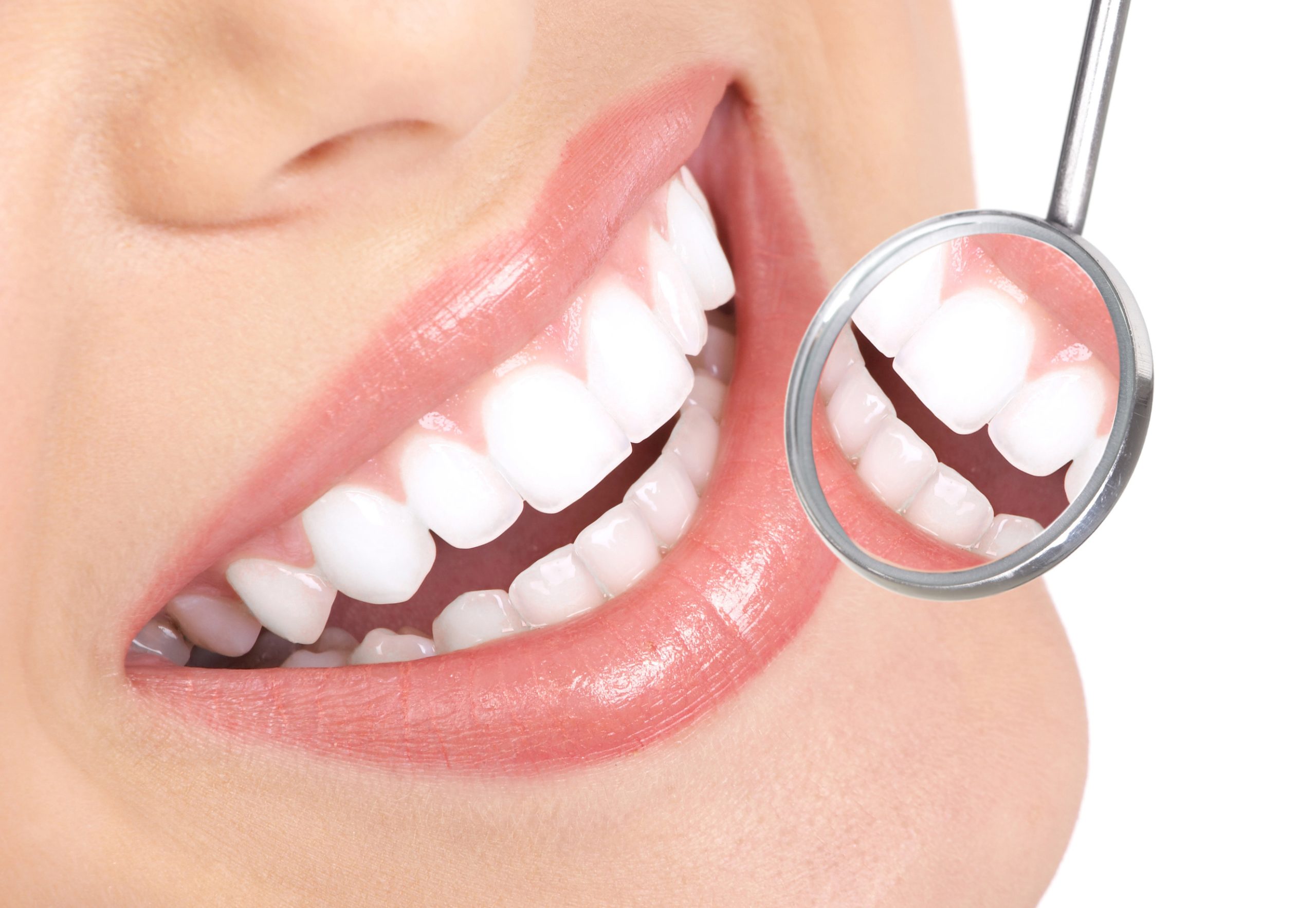 All You Need to Know About SureSmile