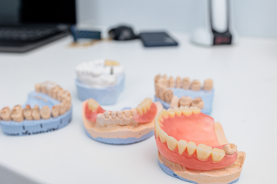 Restore Your Smile and Confidence with Quality Dentures in Tracy, CA