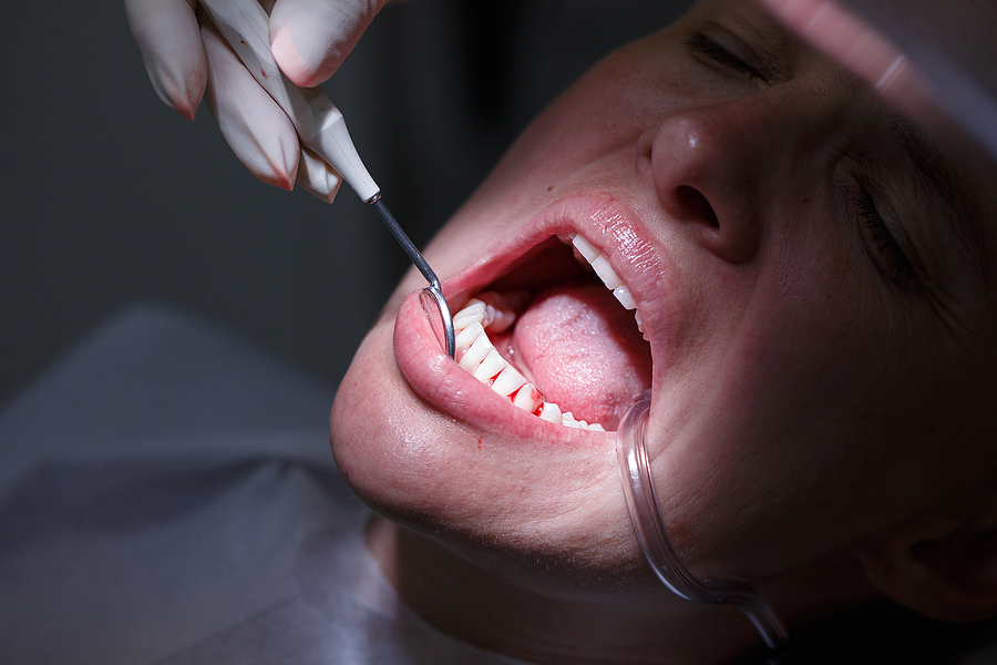 Comprehensive Care for Gum Health: Exploring Periodontics in Tracy, CA
